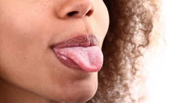 How to lose face fat fast Tongue exercise